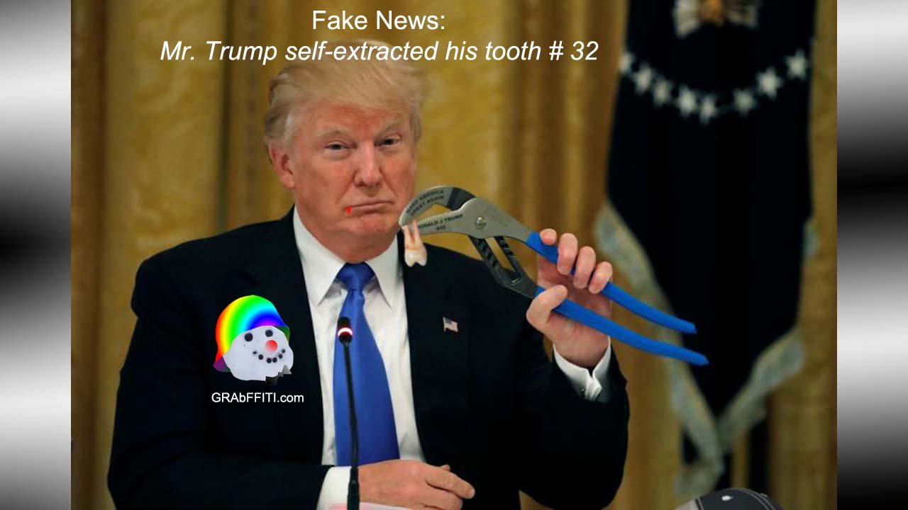 Satirical image. Mr. Trump holds his own self-extracted tooth number thirty two with a big blue propaganda tool.